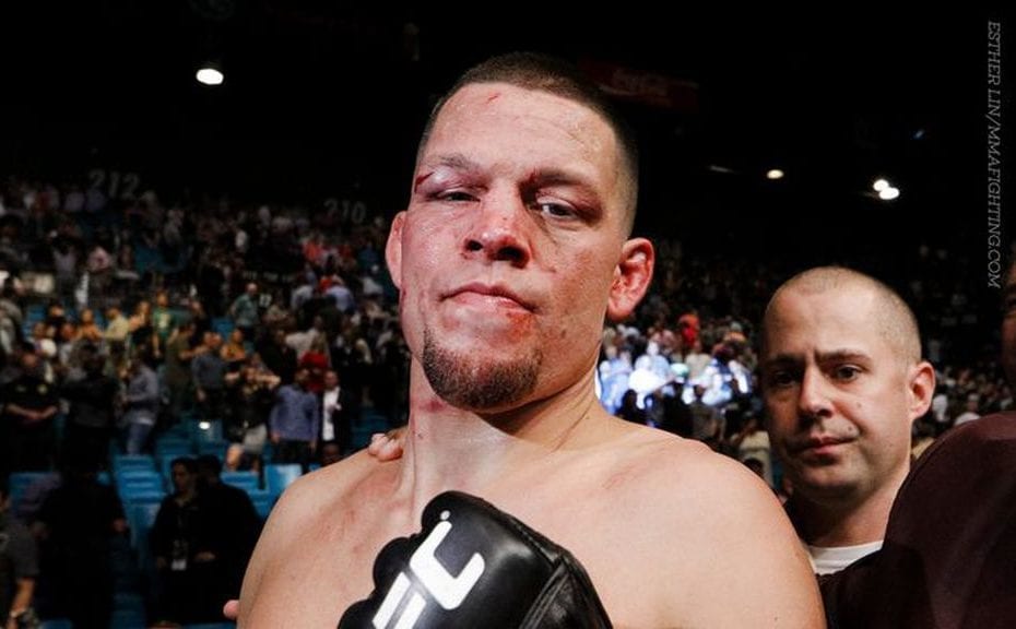 Nate Diaz Hints at Next Possible Move In UFC