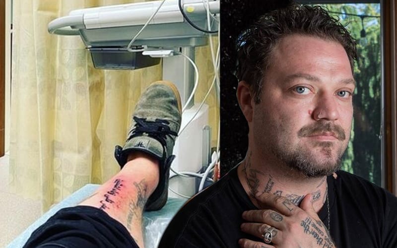 Bam Margera Hospitalized After Tattoo Nightmare Develops Staph Infection