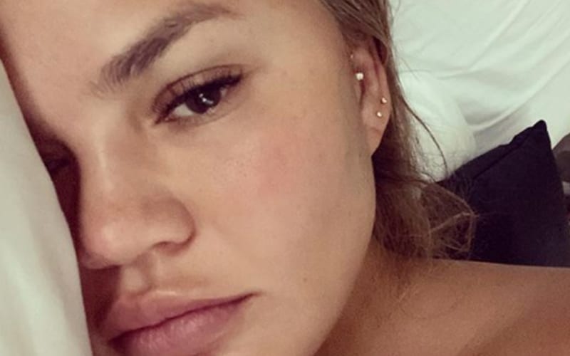 Chrissy Teigen Says She Is Sick Of Herself All Day After Being In The ‘Cancel Club’