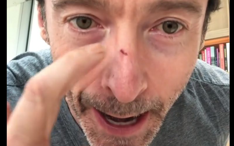 Hugh Jackman Cuts His Nose In Freak Accident On Broadway