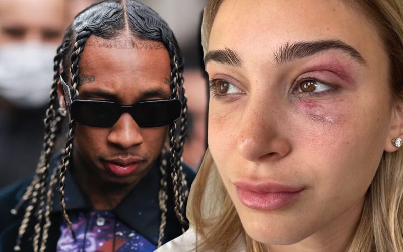 Tyga’s Girlfriend Posts Graphic Evidence Of Alleged Abuse