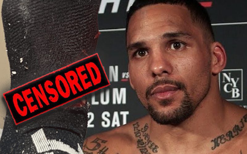 UFC Fighter Eryk Anders Shows Off Nasty Chainsaw Injury
