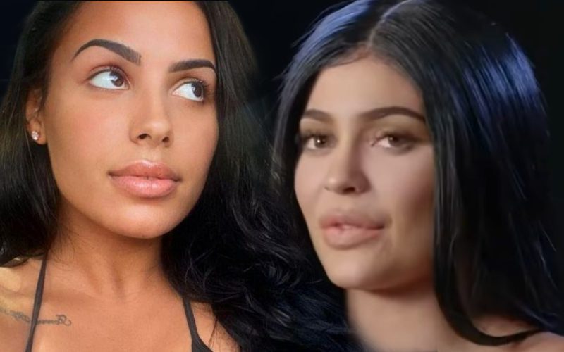 Kanye West’s GF Chaney Jones Shades Kardashians Saying She Has No Cosmetic Surgery On Her Face