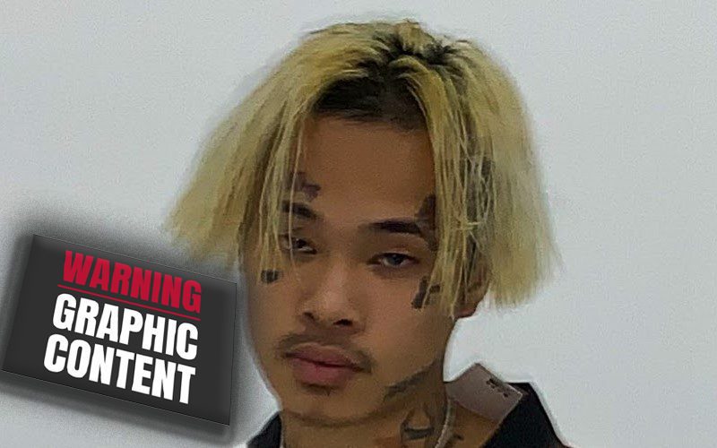 Kid Trunks Shares Graphic Photo After Getting Shot In The Face
