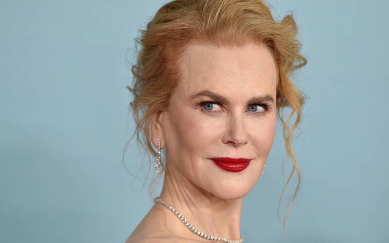 Nicole Kidman Skips Oscar Luncheon Due To Injury