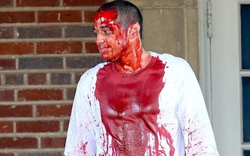 Pete Davidson Covered In Blood For New Movie
