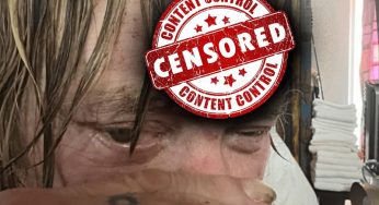 Mickey Rourke Shows Off Graphic Cut On Forehead
