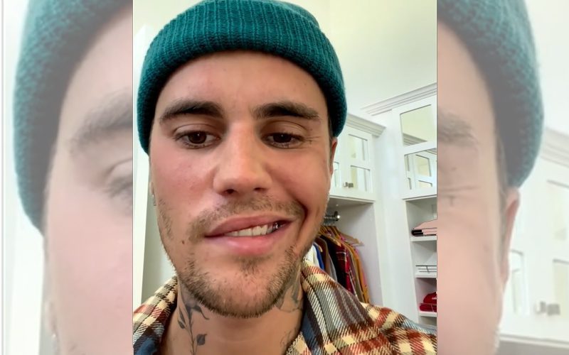 Justin Bieber Says Scary Facial Paralysis Is Getting Better Every Day