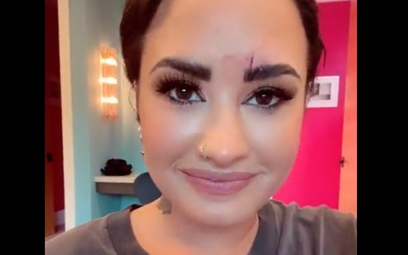 Demi Lovato Suffers Facial Injury Ahead Of Talk Show Appearance