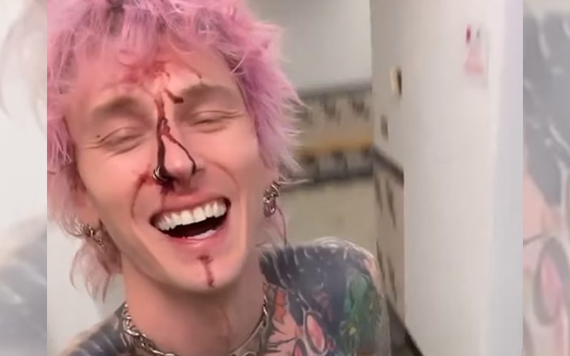 Machine Gun Kelly Shows Off Bloody Face Injury After Mishap During Cleveland Concert