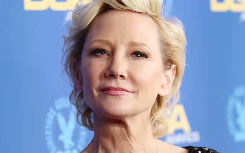 Anne Heche Under Coma In ‘Extremely Critical Condition’ After Fiery Car Wreck