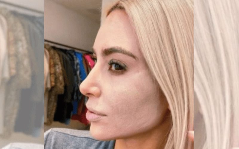 Kim Kardashian Shows Off Her Bare Face With Pores & Psoriasis