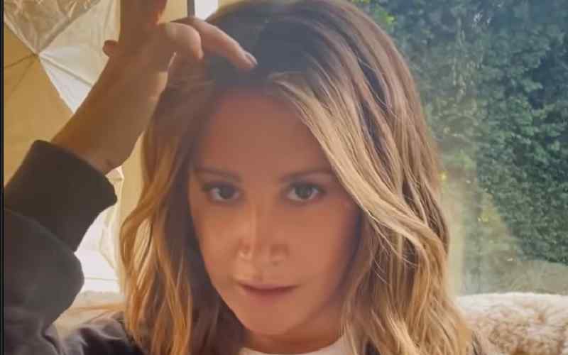 Ashley Tisdale Opens Up About Alopecia Struggles Connected To ‘Stress Overload’
